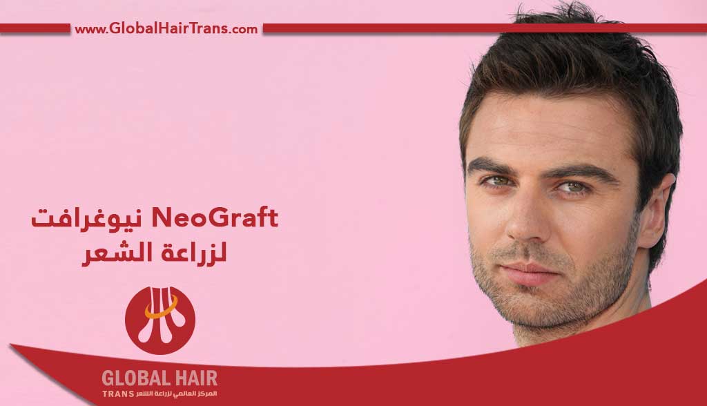 NeoGraft لزراعة الشعر